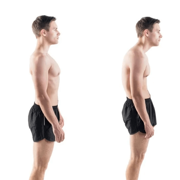 apex-posture-correction